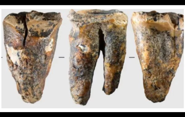 Un diente de 59.000 años de antigüedad ofrece una visión excepcional de cómo los neandertales abordaban un problema médico